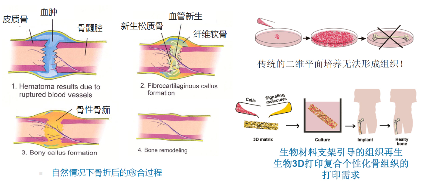 骨组织工程